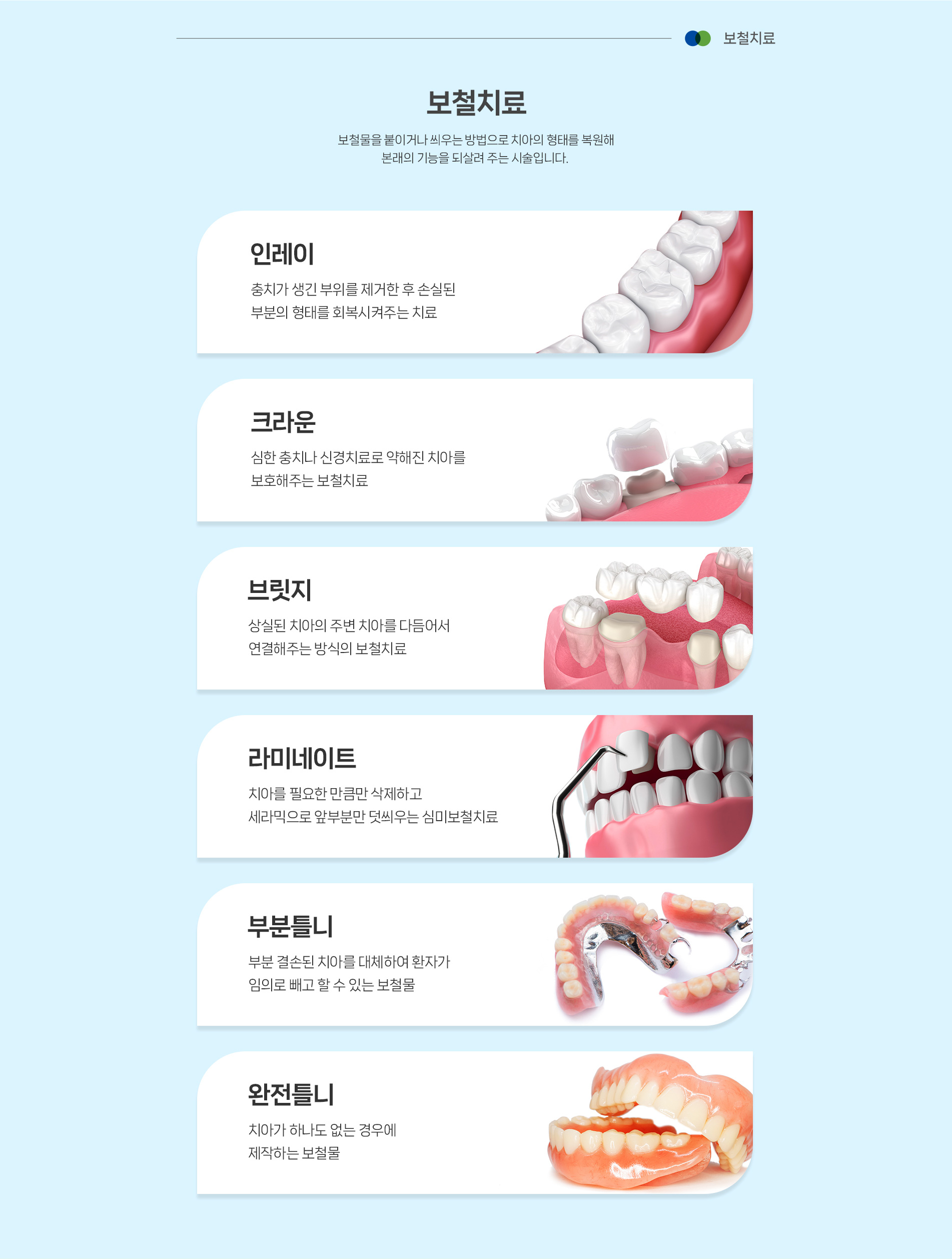 보철치료