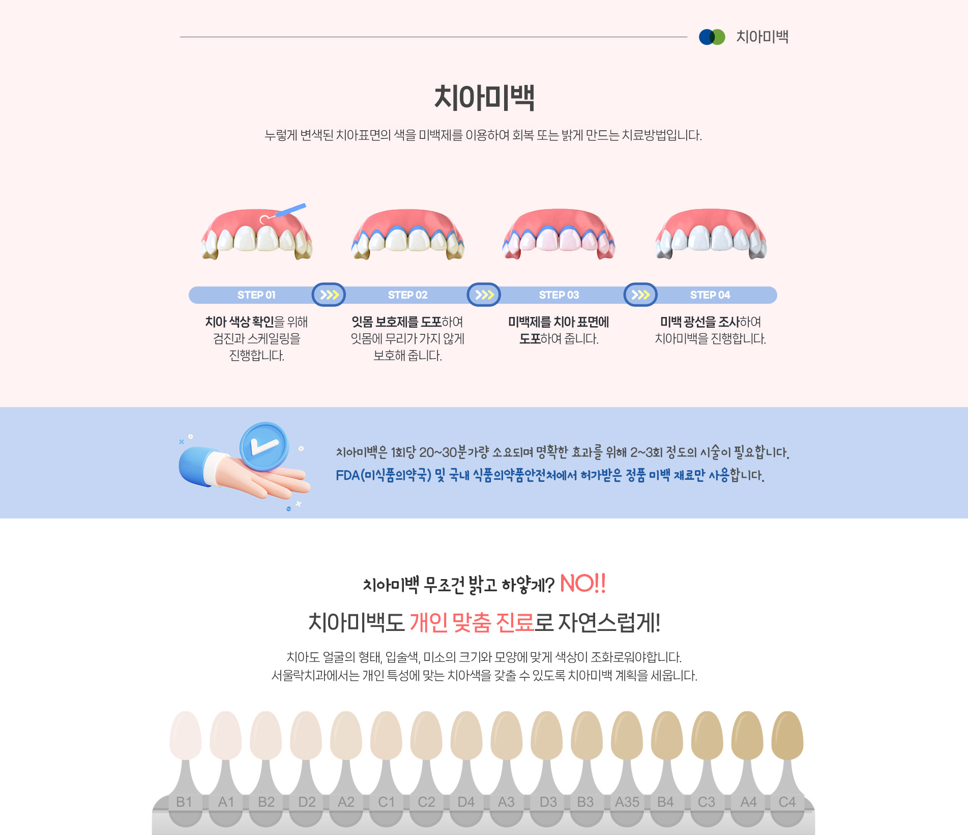 치아미백